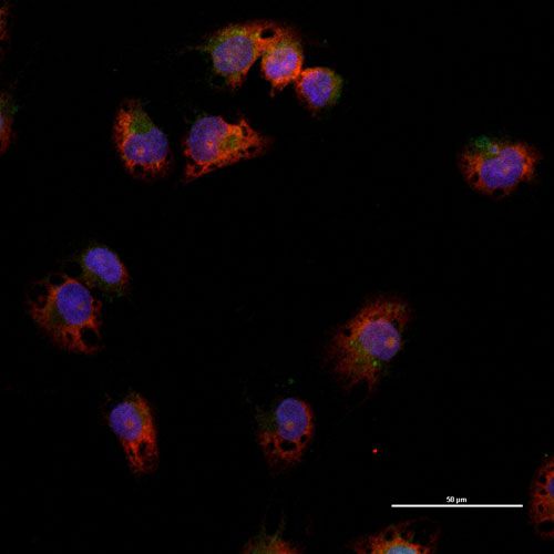 原位雜交(FISH雙標(biāo))